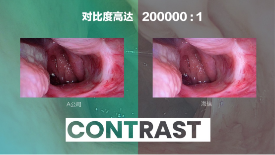 07   海信发布全球首台55吋Mini-LED医用内窥显示器365.png